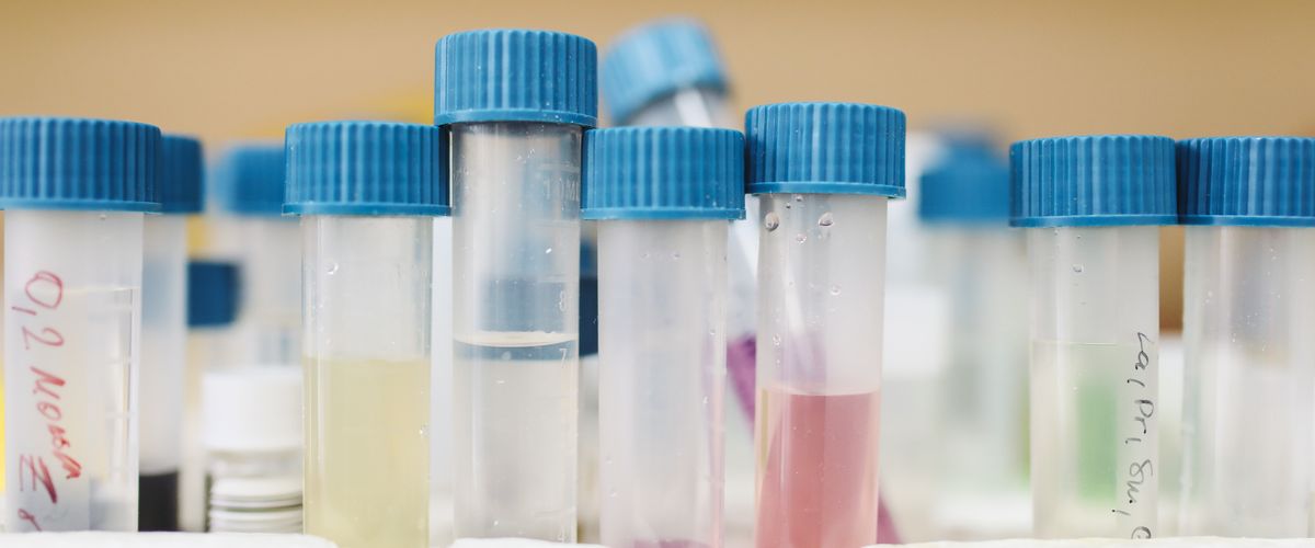 Jak działa test ICP w akwarystyce i co można z niego wyczytać?